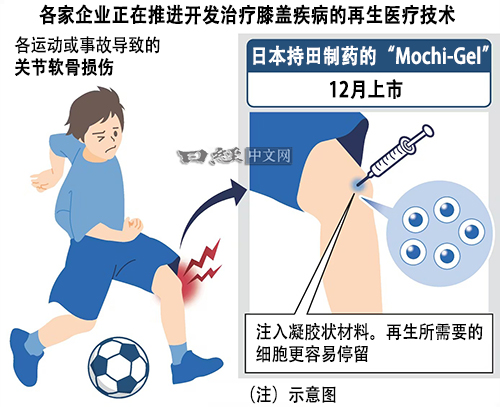 日本推进开发治疗“膝盖疼痛”的再生医疗技术